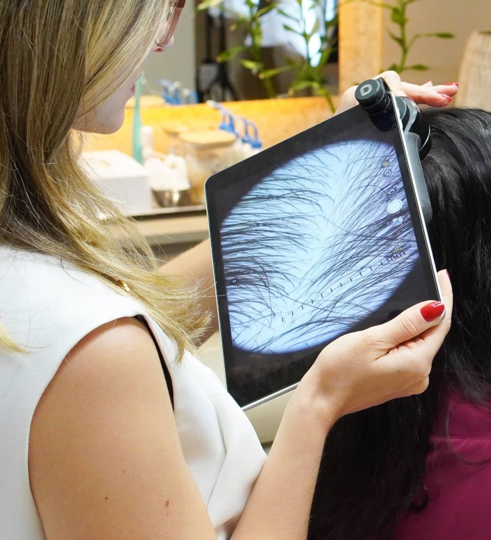 Os Tratamentos Dermatologia Capilar.jpg(1)