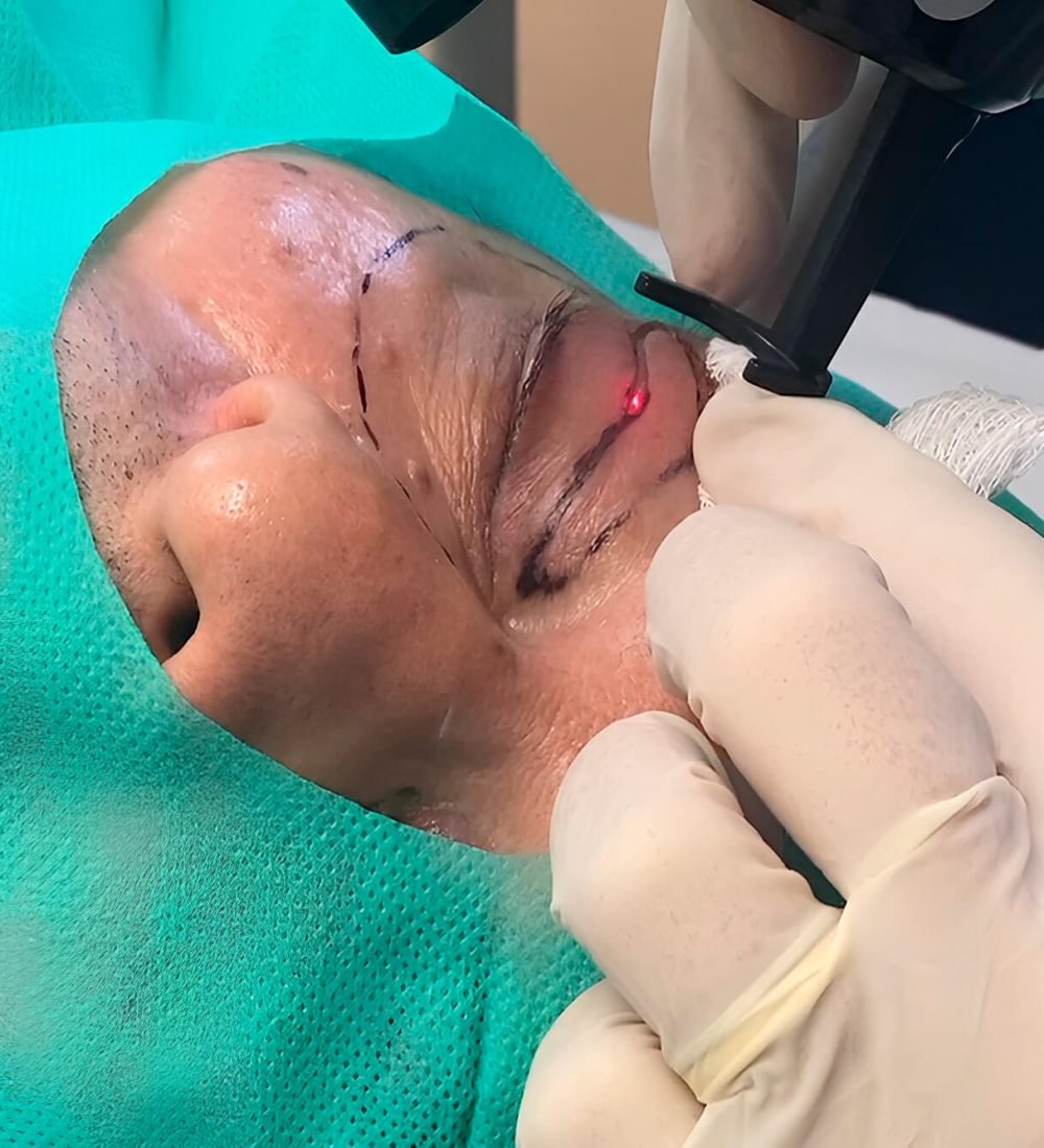 Os Tratamentos Dermatologia Cirúrgica.jpg(1)