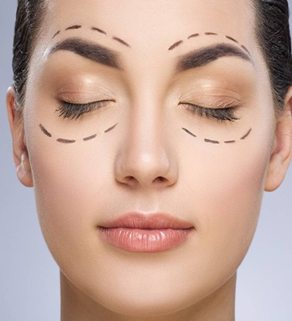 thumbnail-befaroplastia