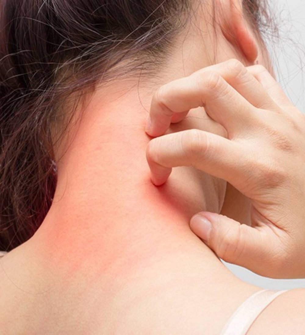 thumbnail-dermatites