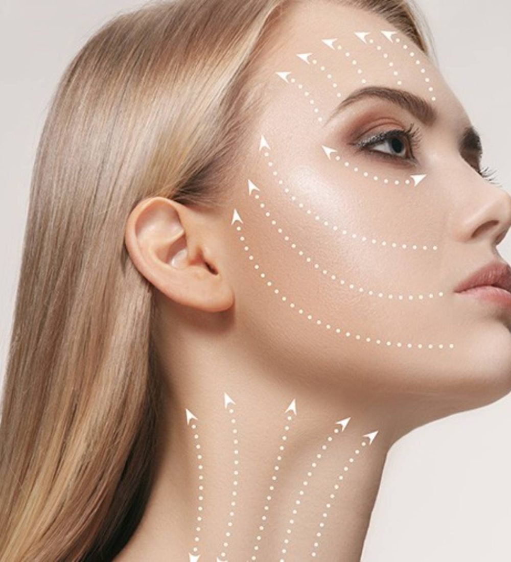 thumbnail-fios-de-sustentacao