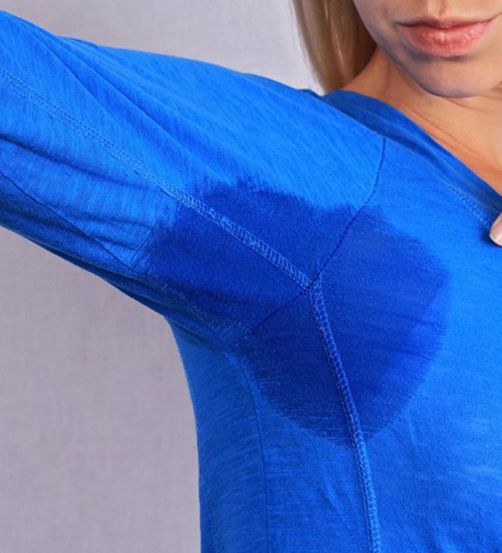 thumbnail-hiperidrose