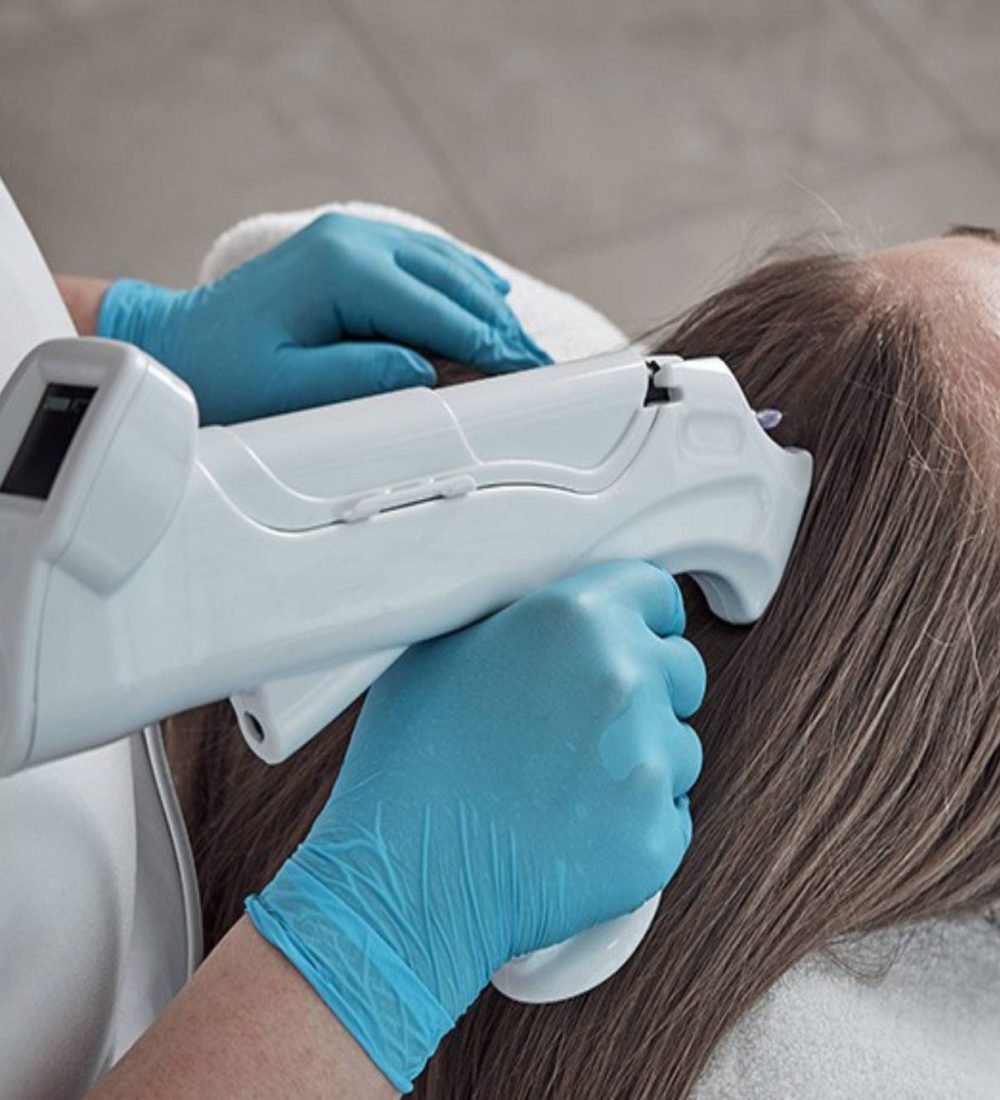 thumbnail-mmp-capilar