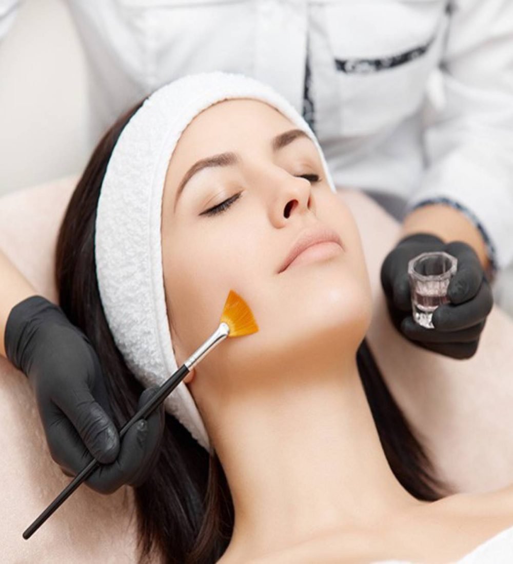 thumbnail-peeling-de-fenol