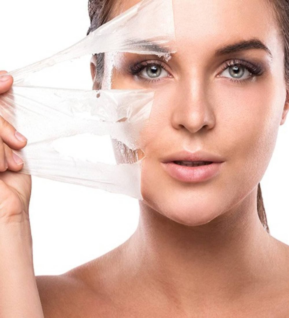 thumbnail-peeling-quimico