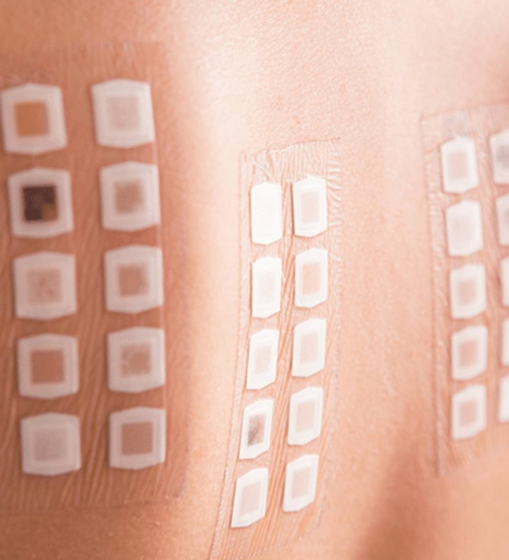 thumbnail-teste-alergico-de-contato